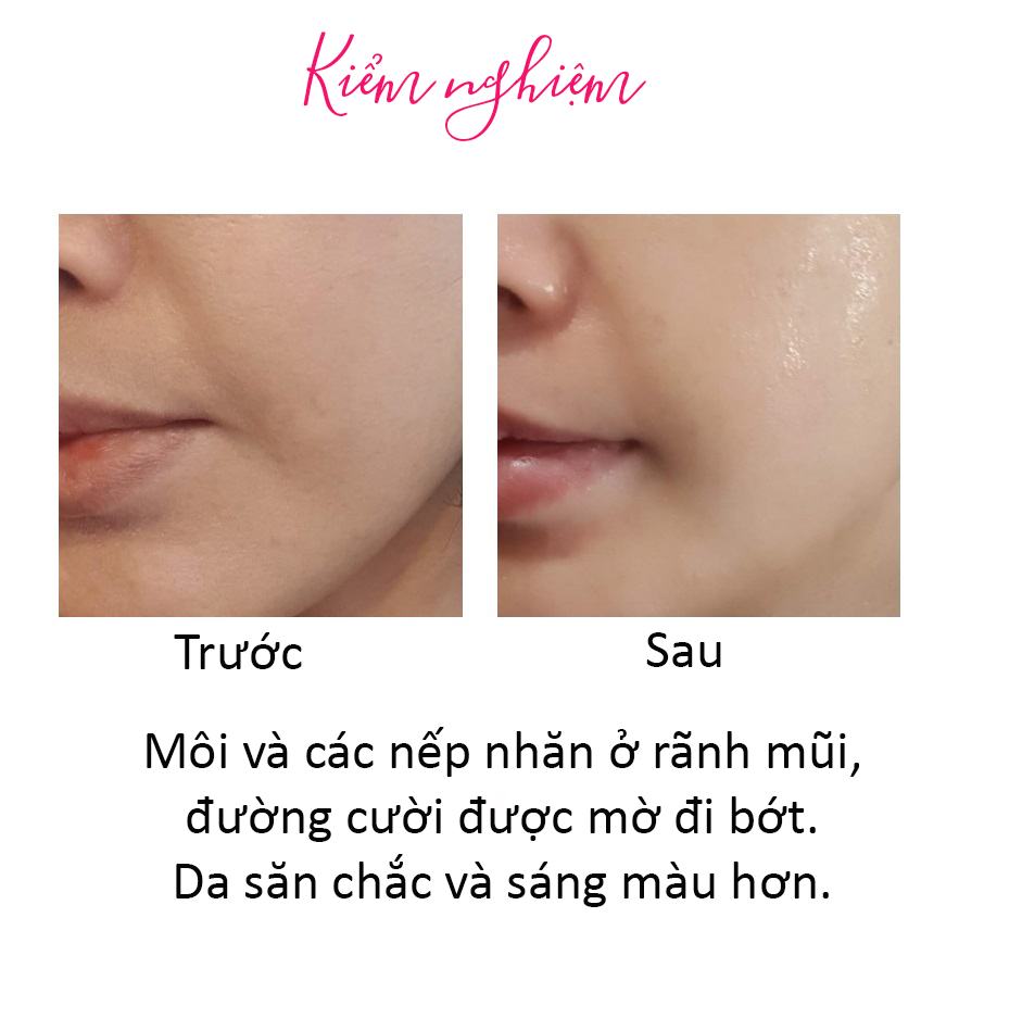 Mat Na Idebenone Wrinkle Maskpack 7